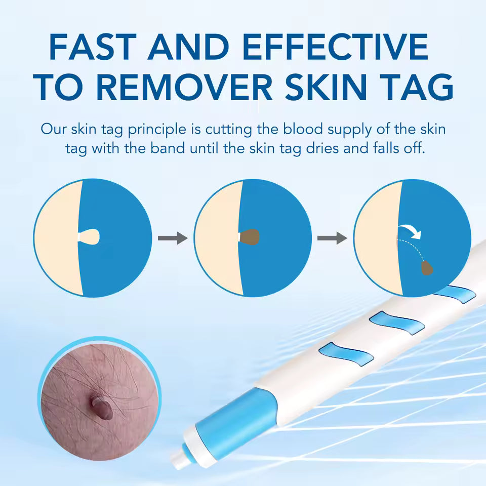 Skin Tag Remover
