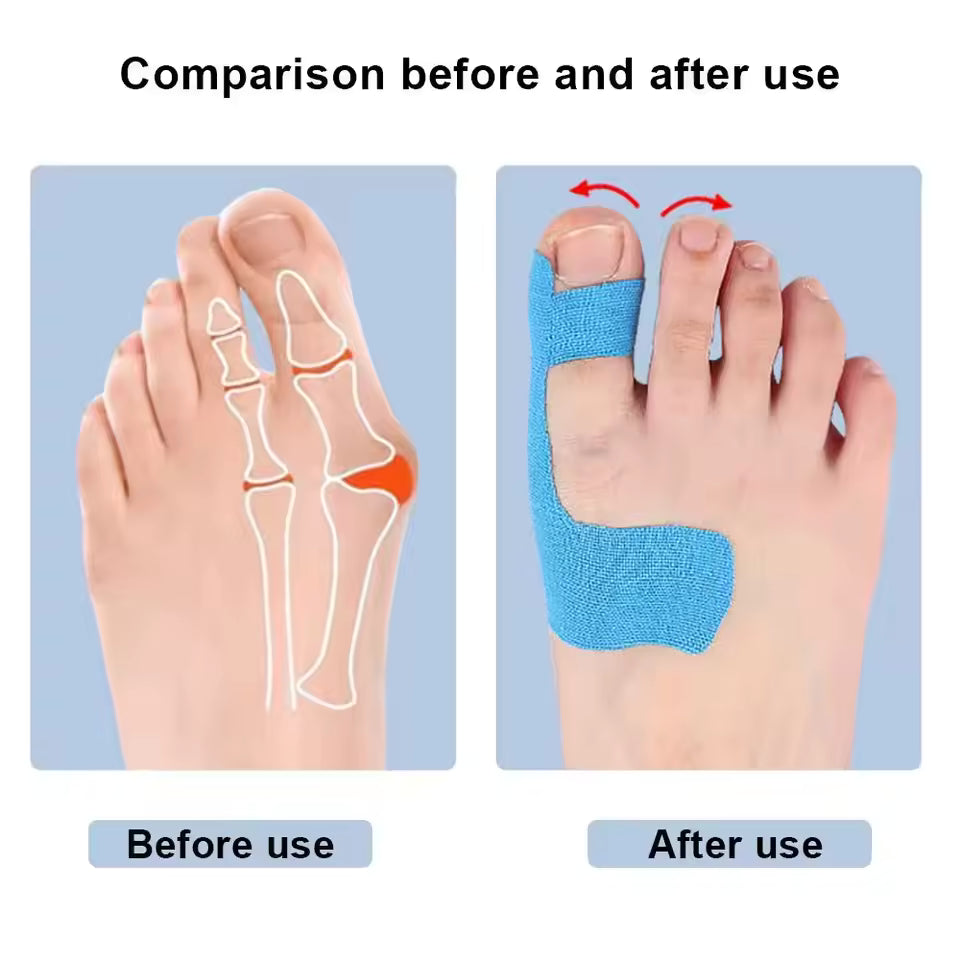 Toe Corrector Tape